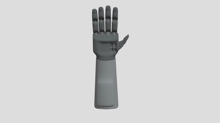 Prosthetic arm