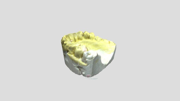 Single Denture Upper Cast Scan 3D Model