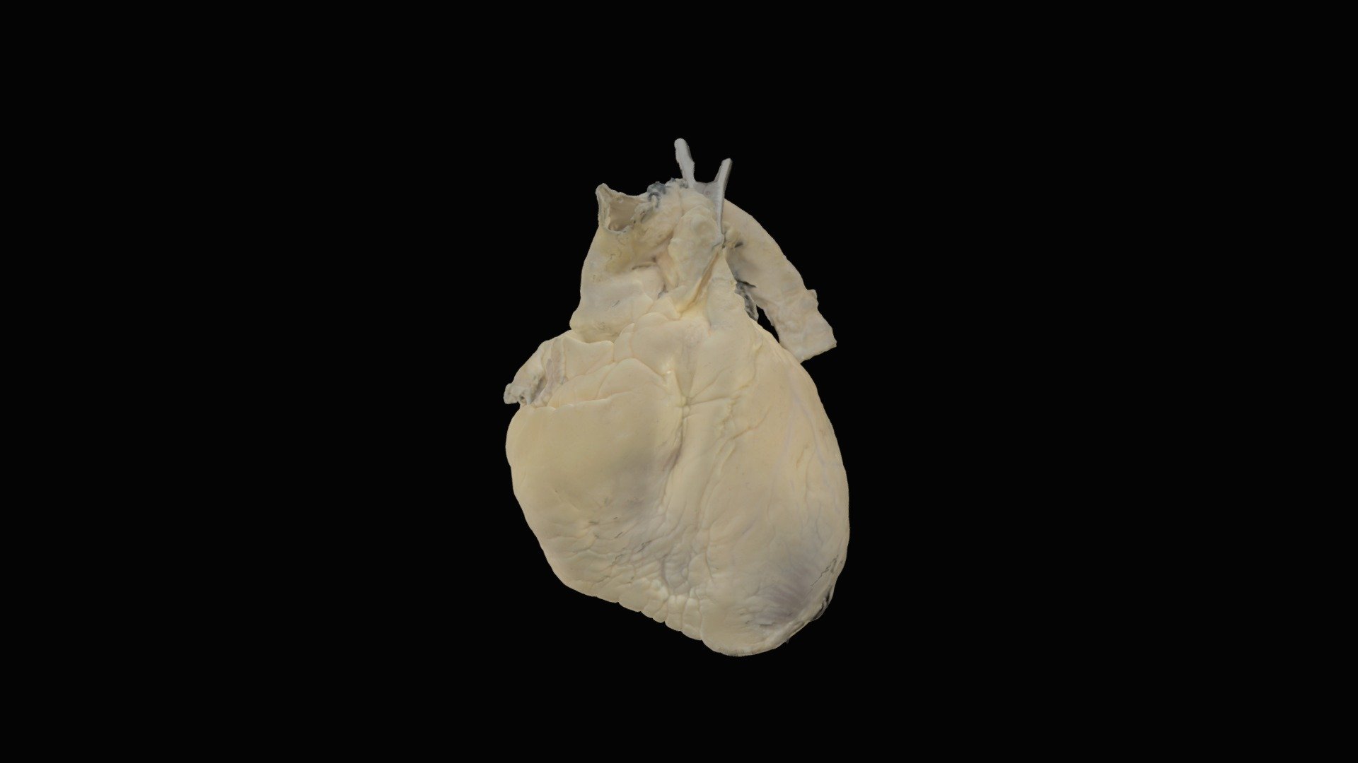 Perfusion Fixed Human Heart #0475