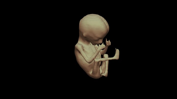 Foetus 3D Model
