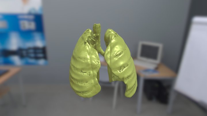 Lungs 3D Model