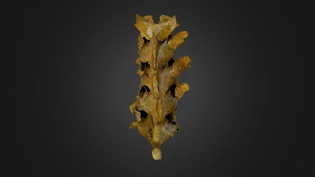 Ankylosing Spondylitis