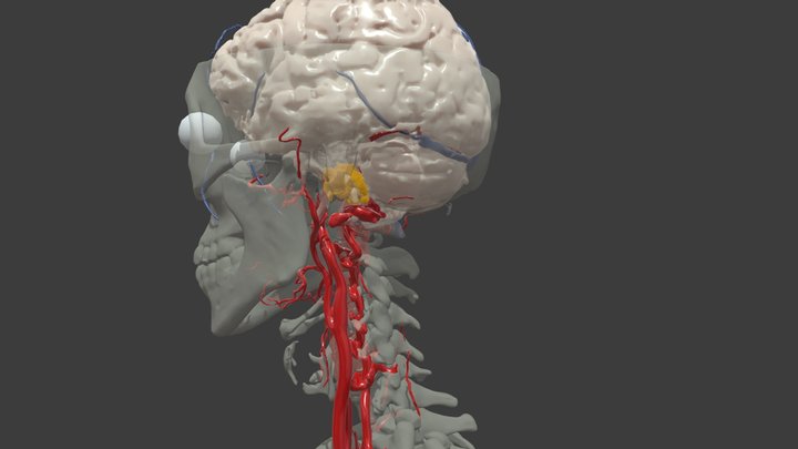 scan:cancer 3D Model