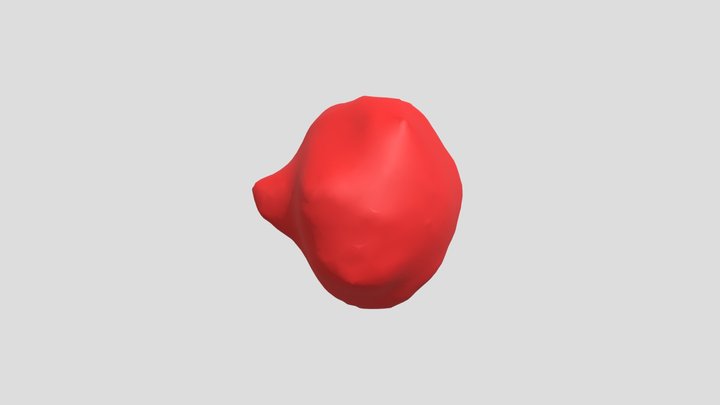 Brain Tumors 3D Model