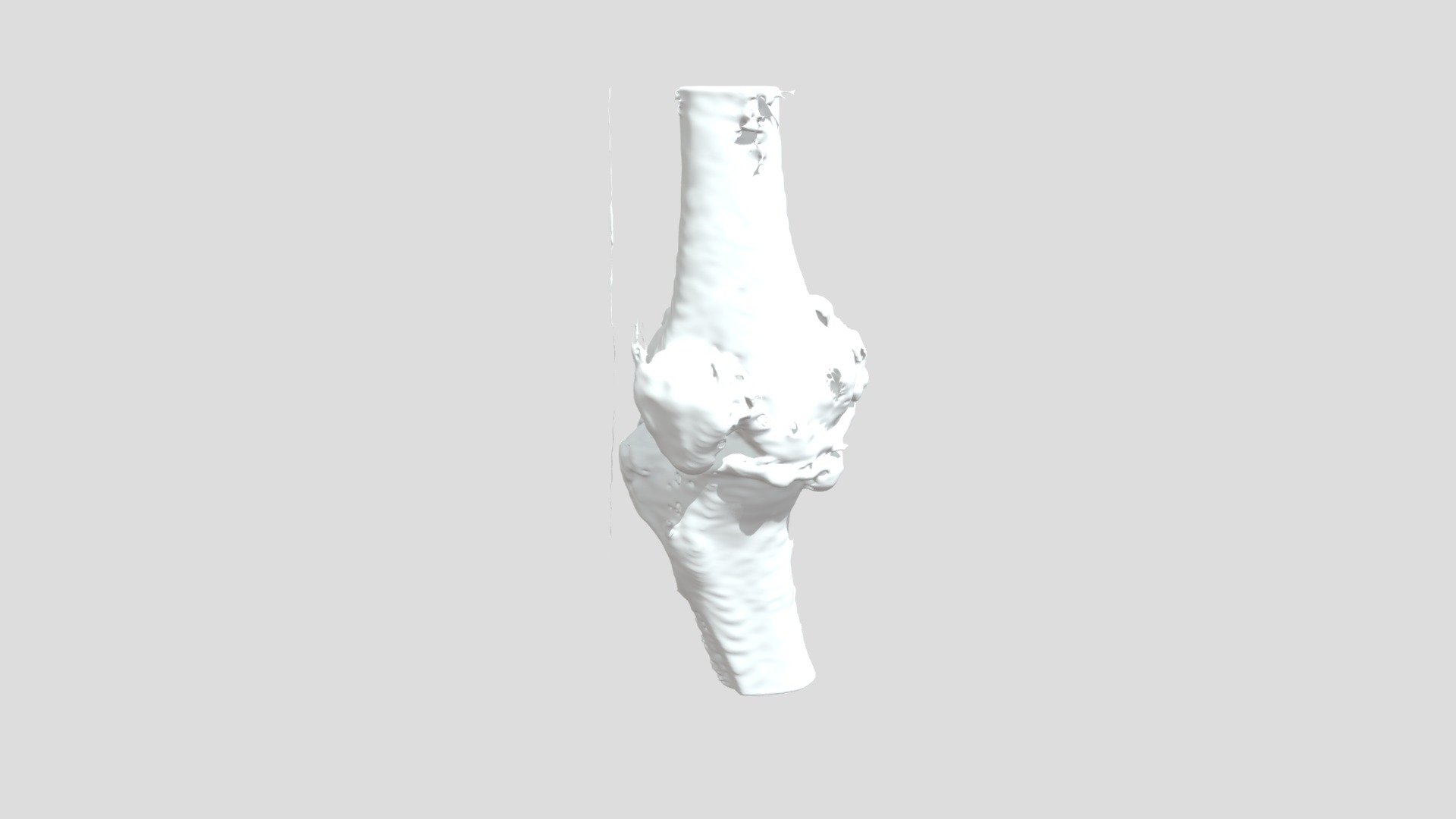 Segmentation Pre Yag Rt Bone - 3D model by curisdata.science [c3f42ef ...