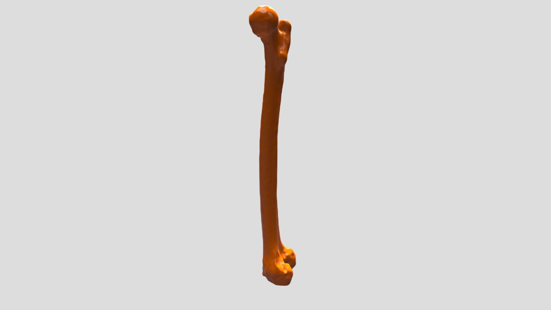 Femur