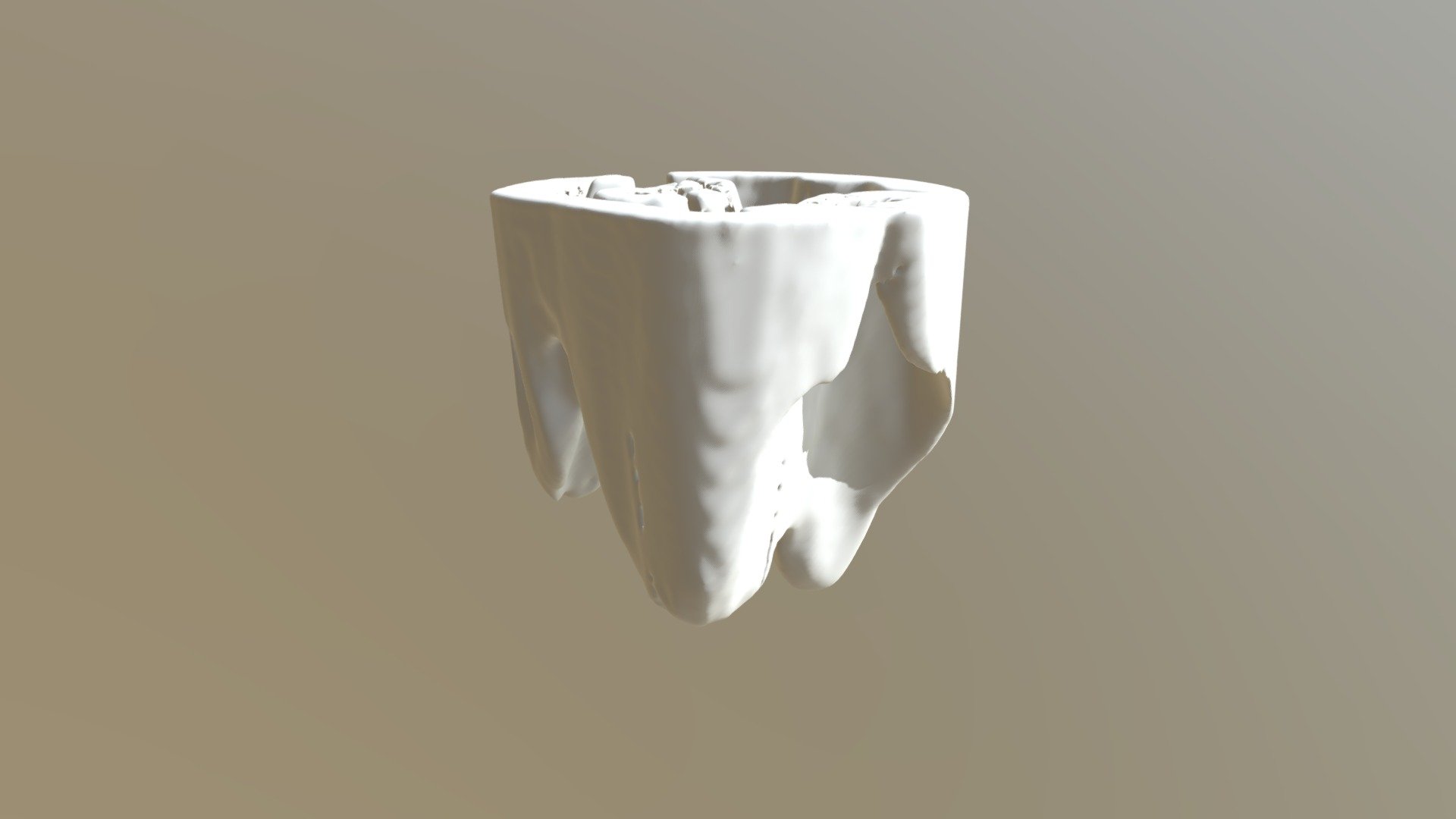 Tooth small scan