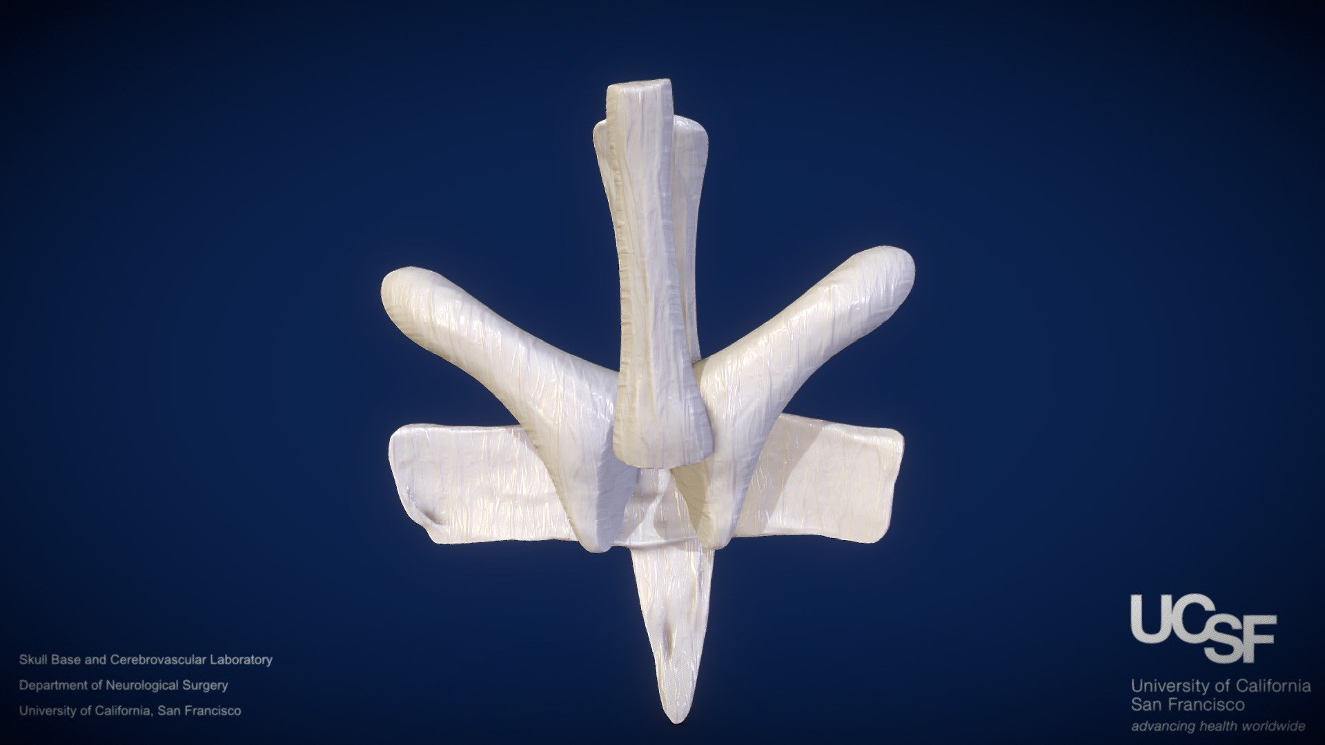 Model 4: Ligaments