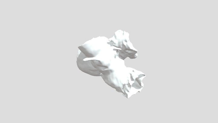 Mitral Valve In Valve 3D Model