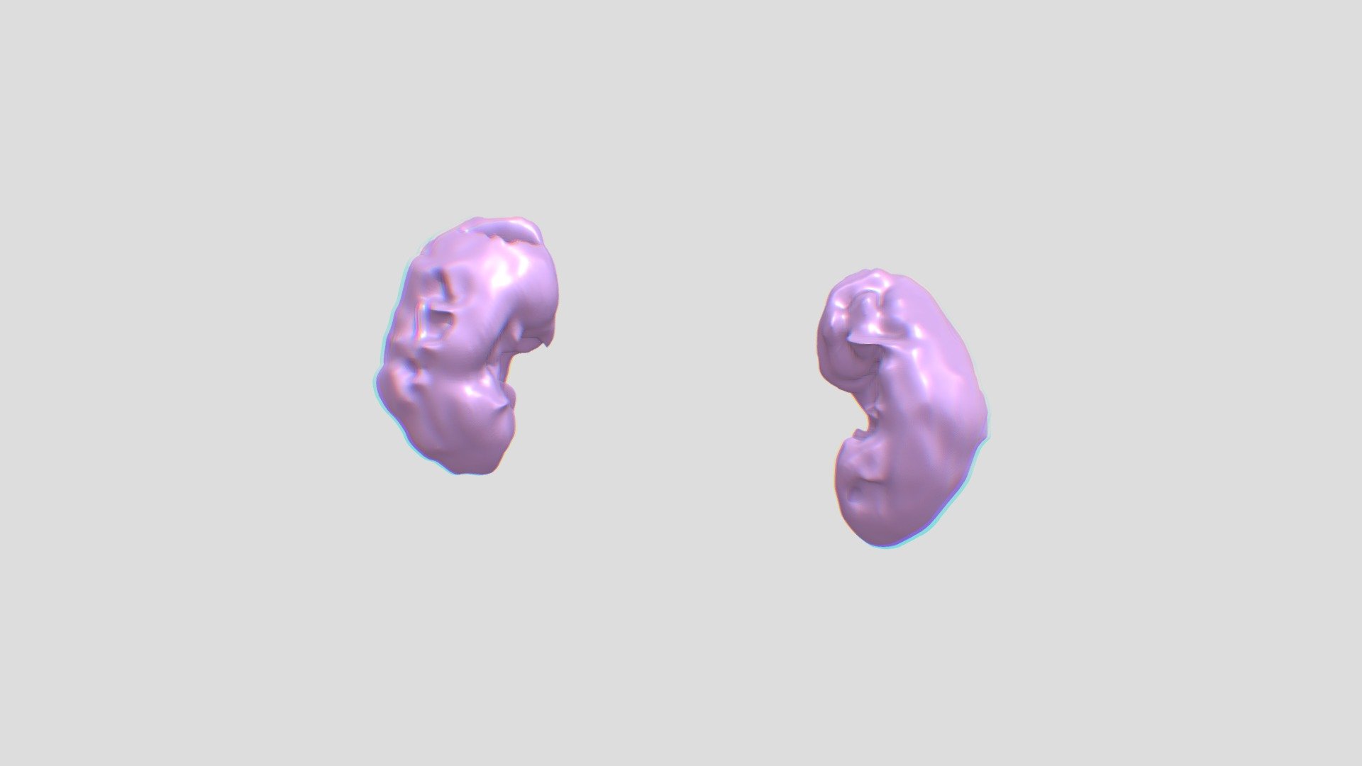 Segmentation_Kidney