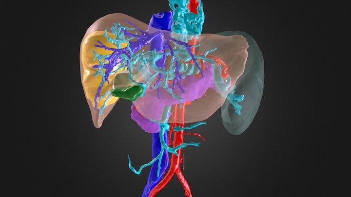 liver 3D Model