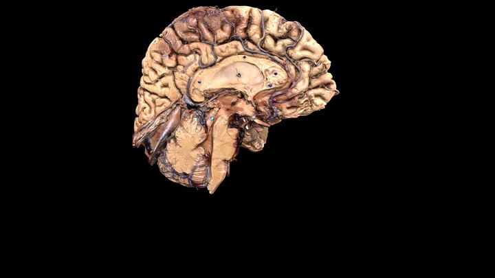Inner Surface of Cerebral Hemisphere Pt.1 3D Model