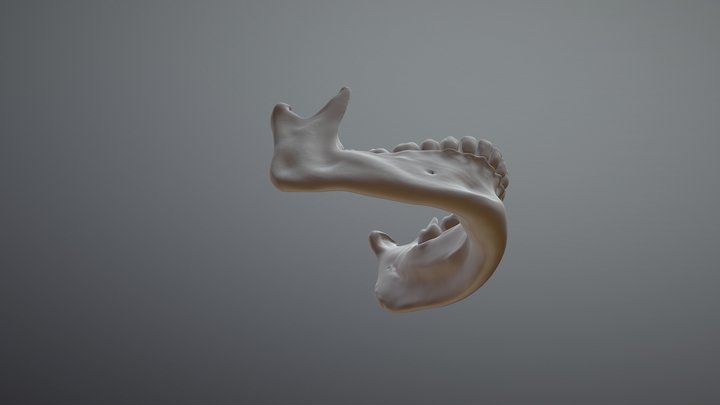 Mandible CT Scan Extraction 3D Model
