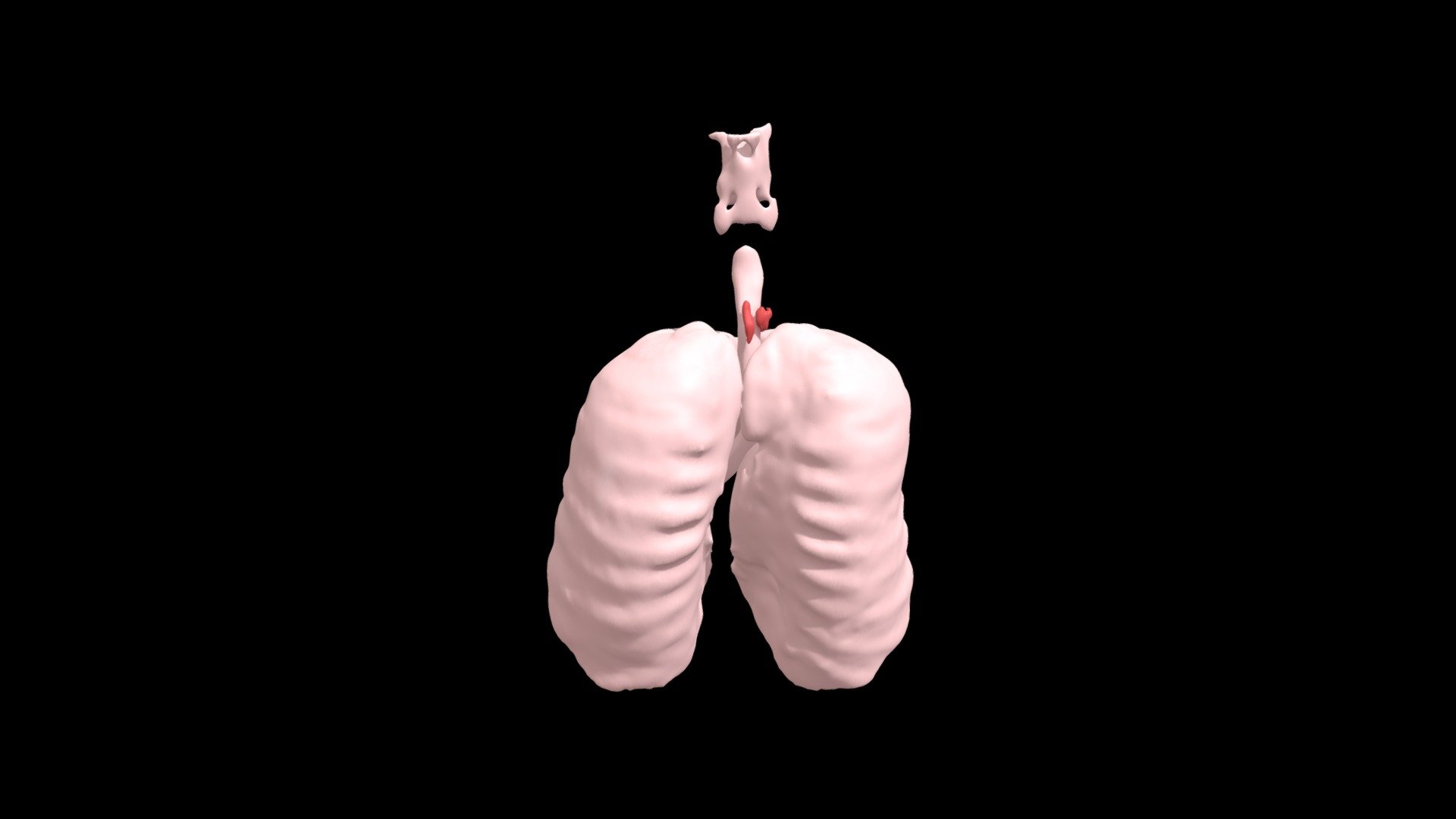Diverticulum