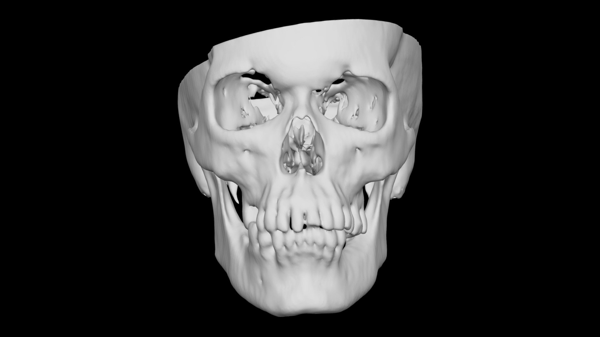 Skull Female 52yo