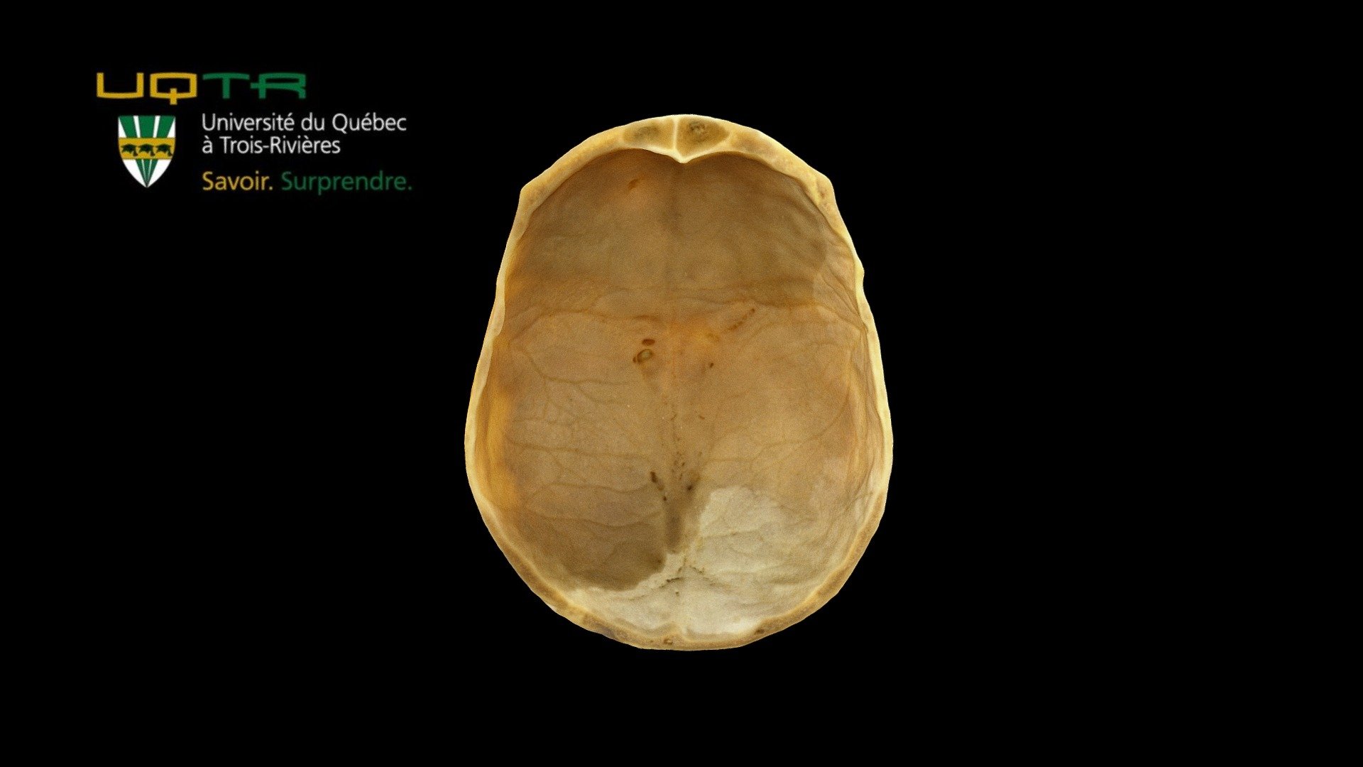 Voûte crânienne / Cranial vault - 3D model by Anatomie UQTR - Anatomy ...