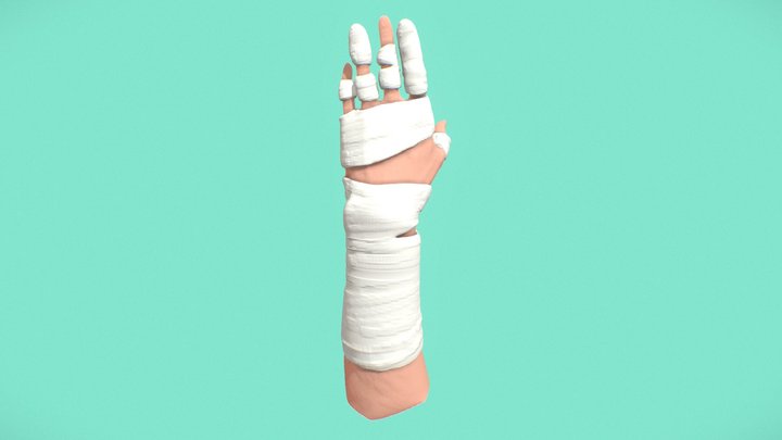 Bandaged Hand – Modello 3D gratuito STL