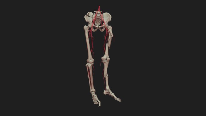 cotm fracture 3D Model