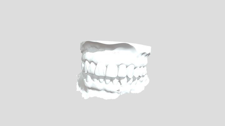 Wax Up 2 3D Model