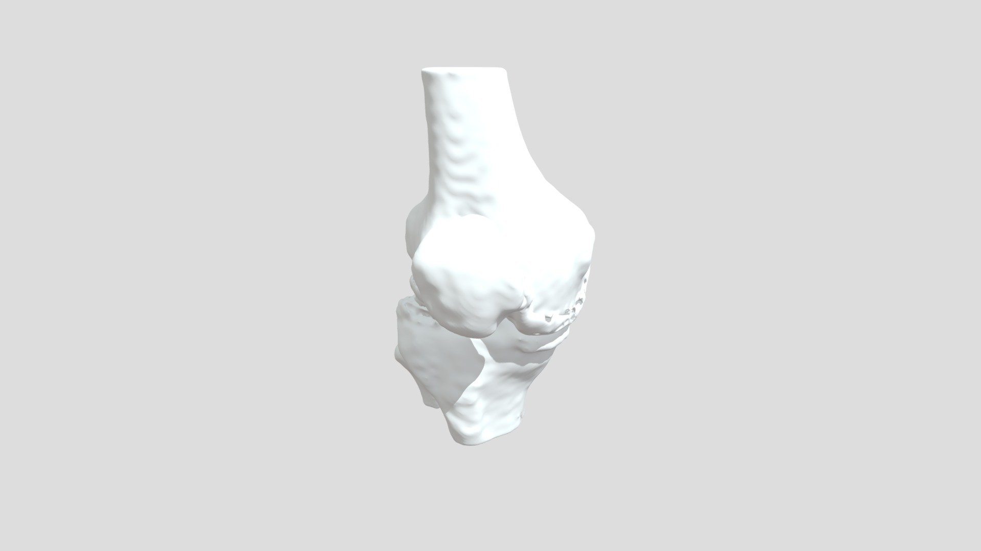 Segmentation Segment 2