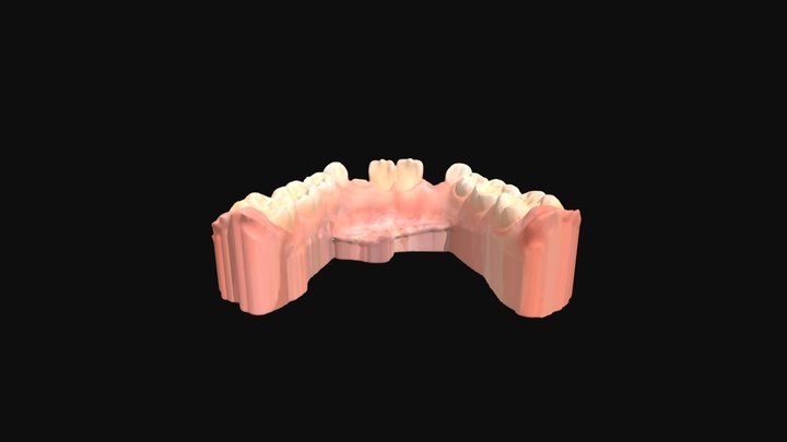 Caso 1 dentición mixta- Arcada inferior 3D Model