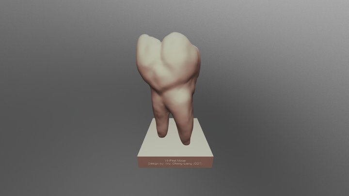 16- first molar 3D Model