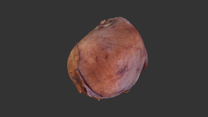 Utero 3D Model