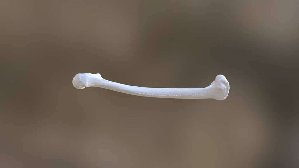 UD4 Femur