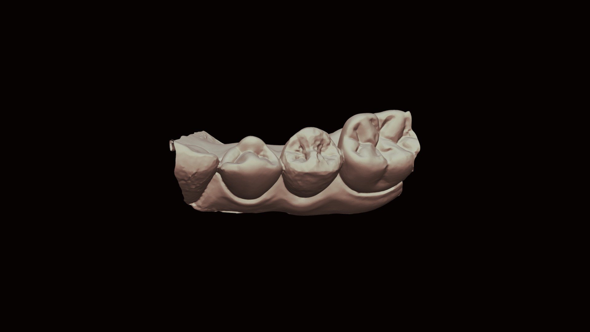 20d, Group 7 Lower Jaw