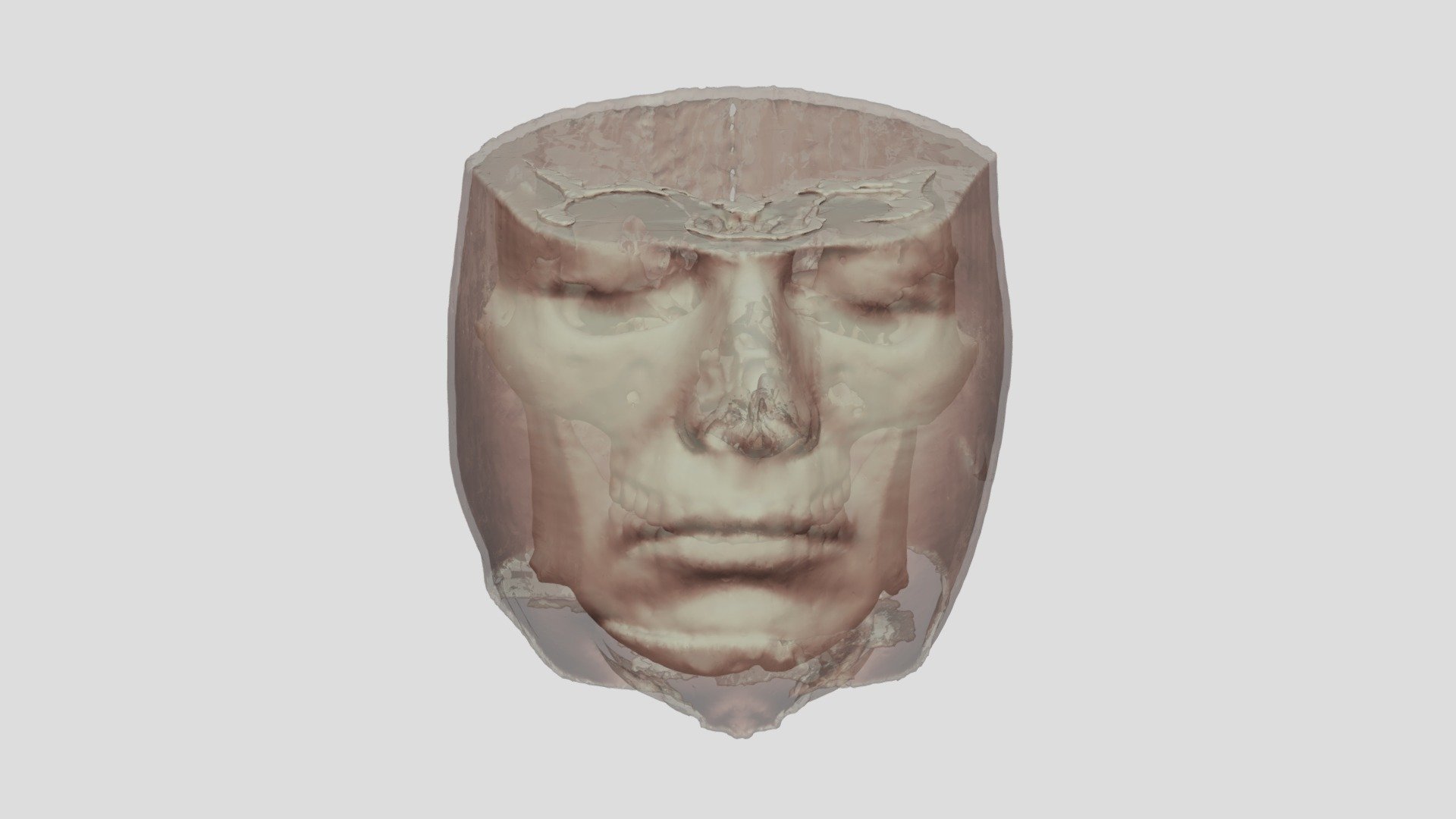 Skull with soft tissue Download Free 3D model by anonuser321 [c7f5a08