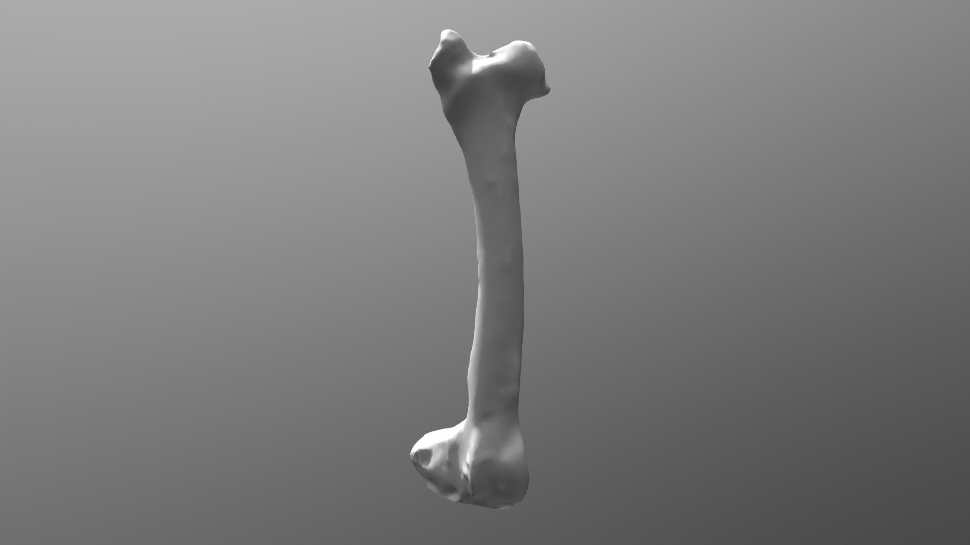 Bone