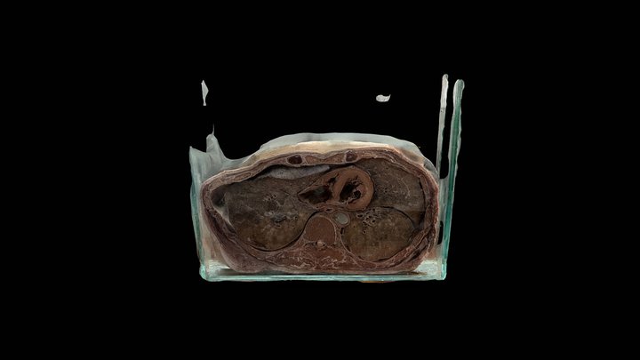 CORTE AXIAL DE TORAX - NIVEL T5-T6 3D Model