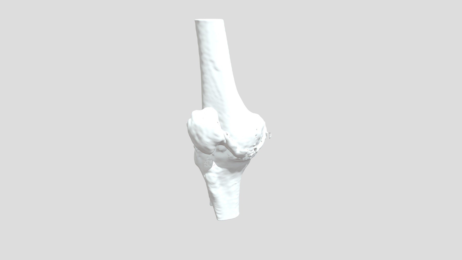 Segmentation Psha Rt Bone - 3D model by curisdata.science [c8300f0 ...