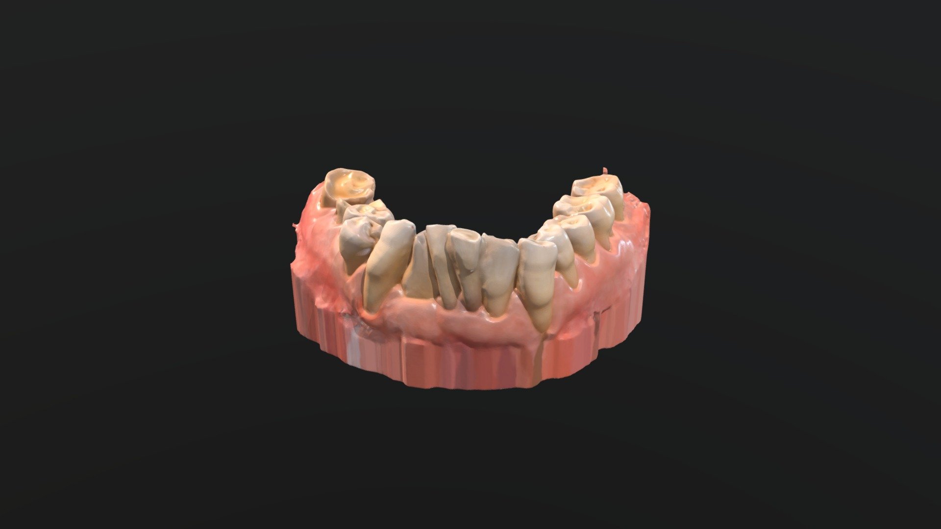 Reto diagnóstico 2- Arcada mandibular - 3D model by GIDPTD [c878fbd ...