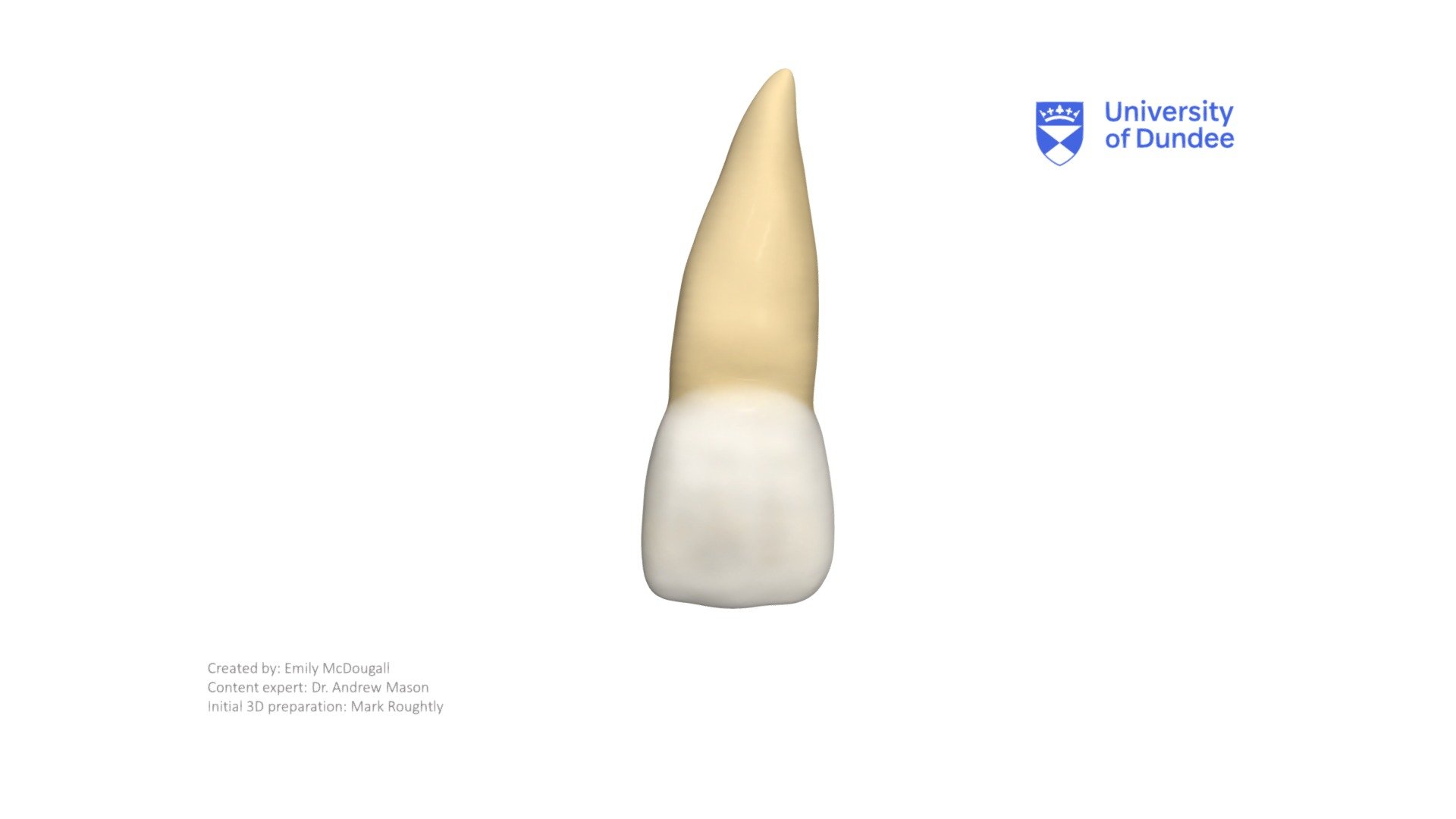 maxillary central incisor