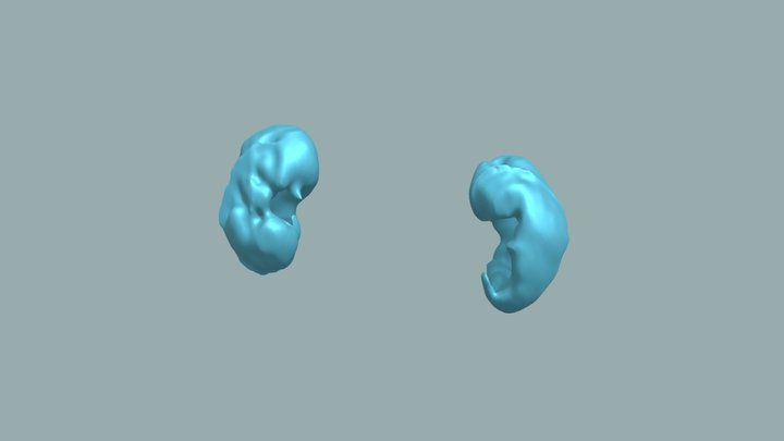 Segmentation_Kidney 3D Model