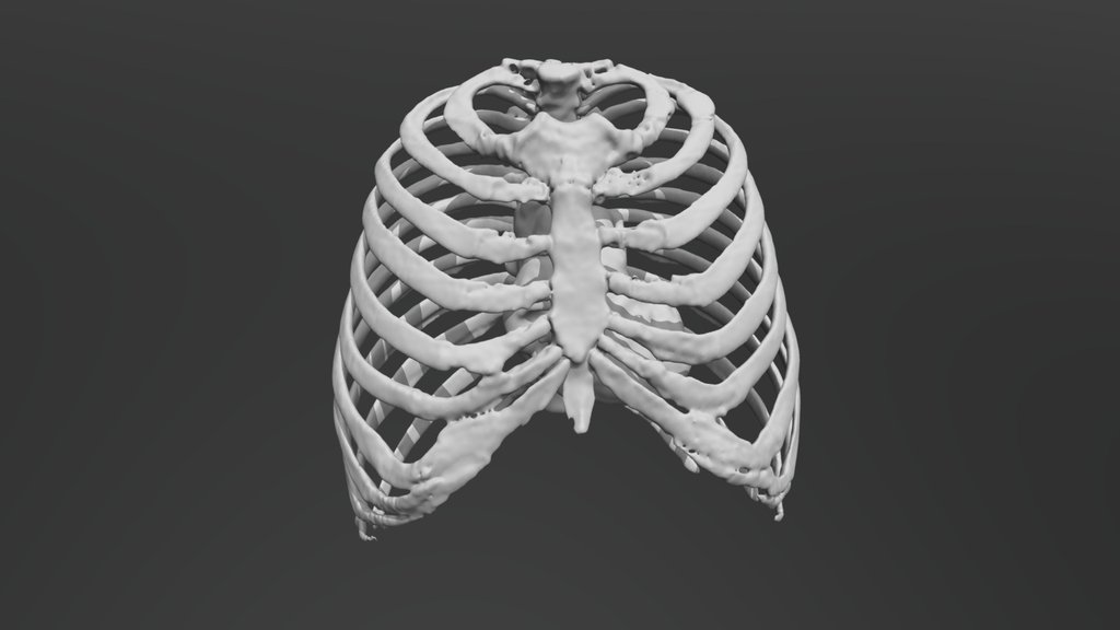 Thorax