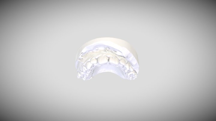 Model diagnostyczny ortodontyczny (szczęka) 3D Model