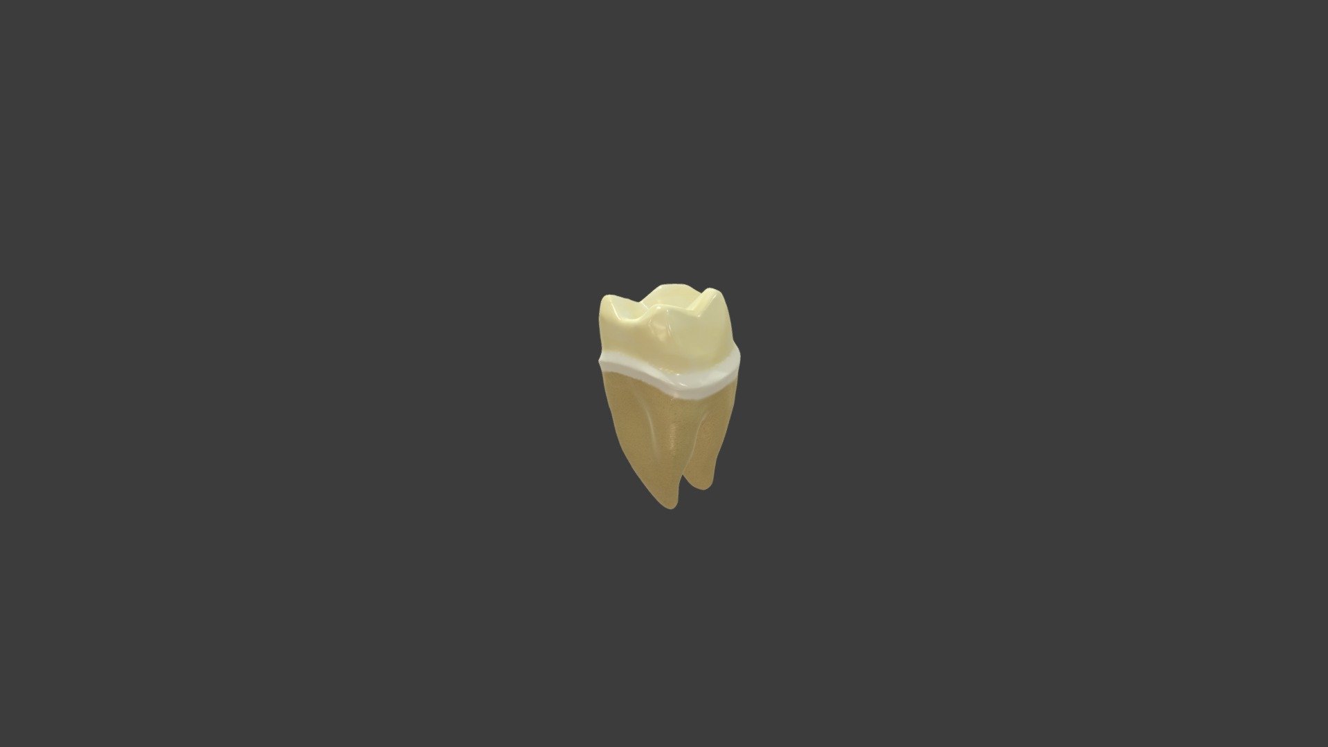 Gold Crown Molar Preparation 3D model by Ahmed Mahrous