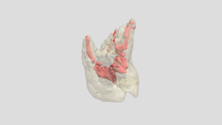 CT 27 Paramolar cust 3D Model