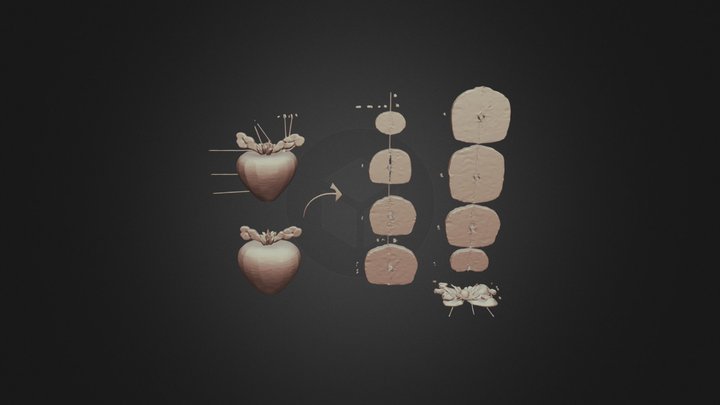 Prostate-3.jpg 3D Model