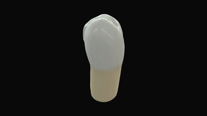 Cavidad compleja premolar maxilar 3D Model