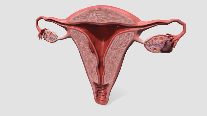 Coronal Cross-Section of Uterus with Endo 3D Model