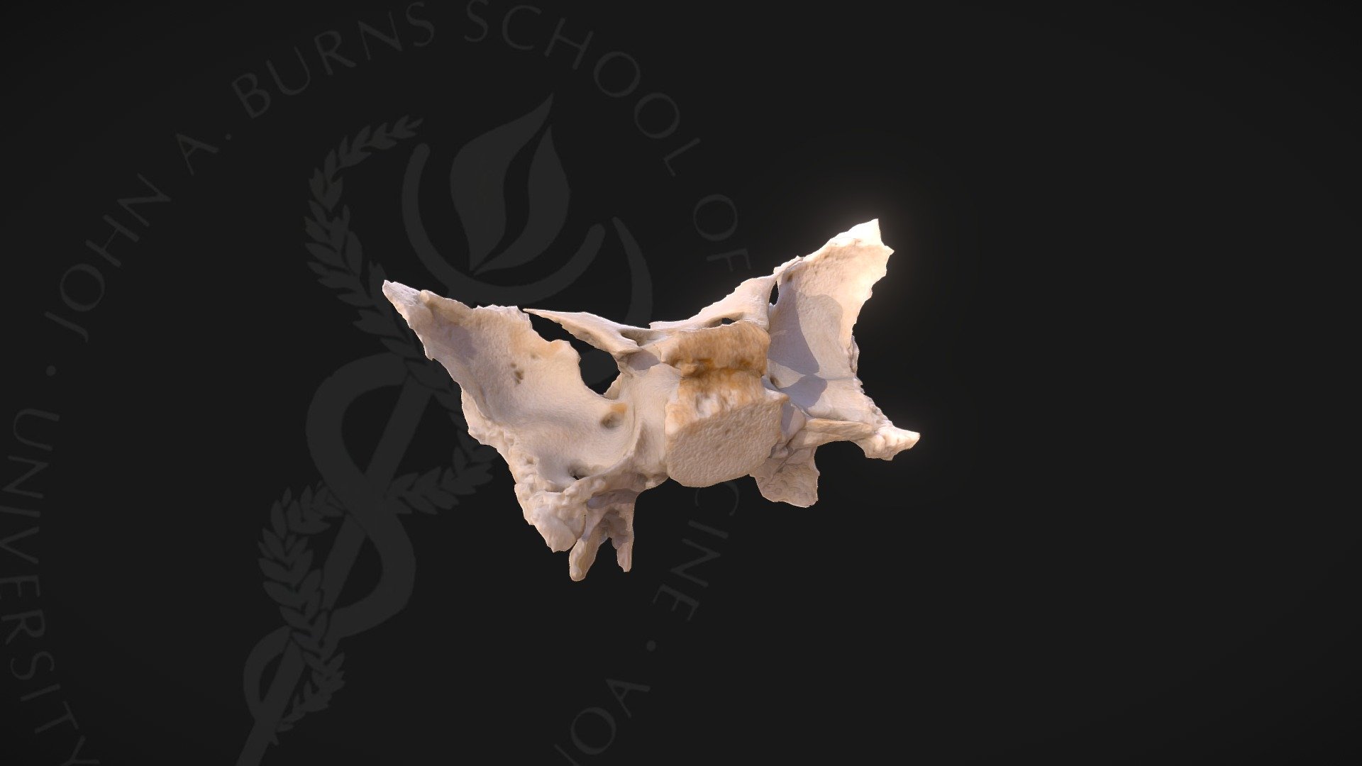 Sphenoid - duplicated version