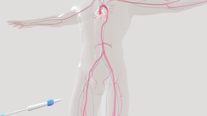 3 3D Model