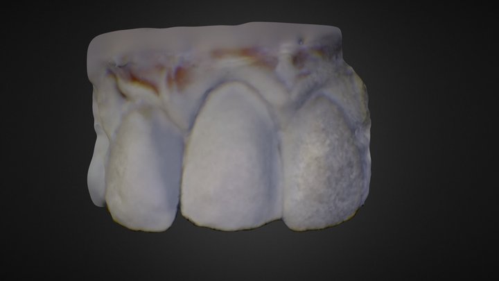 Tooth 2 Clip 3D Model