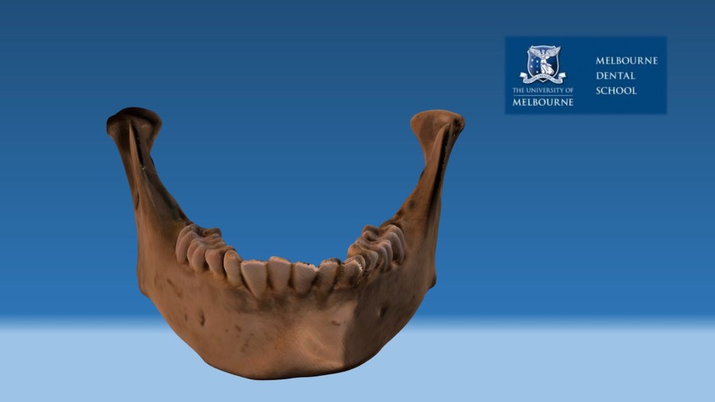 Human mandible, mixed dentition