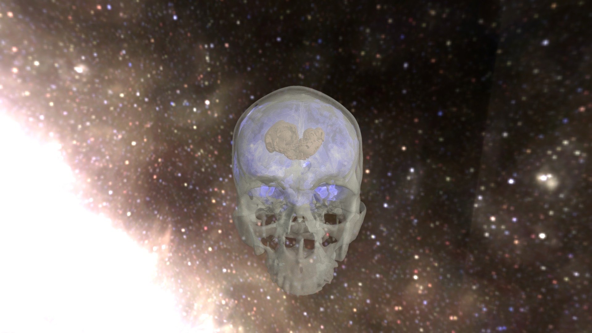 Skull, Brain, And Tumor