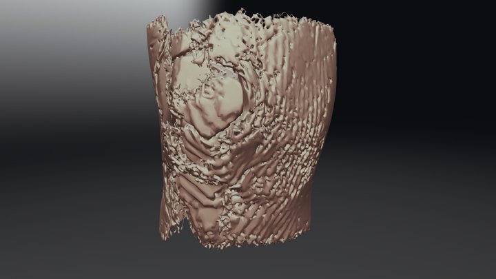 Knee CT-scan TEST 3D Model