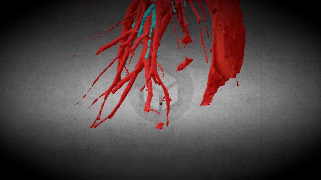 Segmentectomy Planning VR